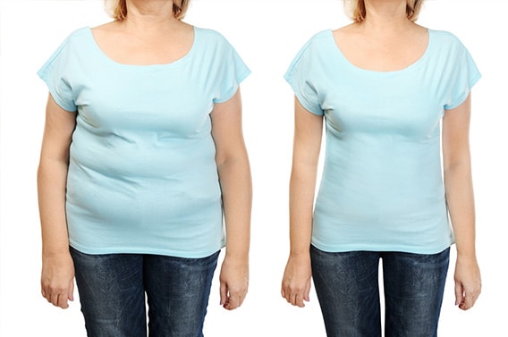 before after weight loss