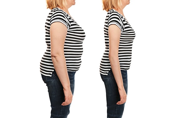 weight loss